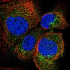 Immunofluorescent staining of human cell line A-431 shows localization to cytosol.