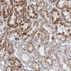 Anti-PDCD11 Antibody