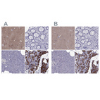Immunohistochemical staining of human cerebral cortex, gastrointestinal, pancreas and parathyroid gland using Anti-AAK1 antibody HPA017931 (A) shows similar protein distribution across tissues to independent antibody HPA020289 (B).