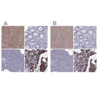 Immunohistochemical staining of human cerebral cortex, gastrointestinal, pancreas and parathyroid gland using Anti-AAK1 antibody HPA017931 (A) shows similar protein distribution across tissues to independent antibody HPA020289 (B).