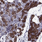 Immunohistochemical staining of human parathyroid gland shows strong membranous positivity in glandular cells.