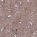 Immunohistochemical staining of human cerebral cortex shows moderate positivity in neuronal processes in neuropil.