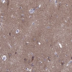 Immunohistochemical staining of human cerebral cortex shows moderate positivity in neuronal processes in neuropil.
