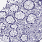 Immunohistochemical staining of human colon shows no positivity in glandular cells as expected.