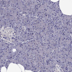 Immunohistochemical staining of human pancreas shows no positivity in exocrine glandular cells as expected.