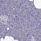 Immunohistochemical staining of human pancreas shows no positivity in exocrine glandular cells as expected.