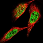 Immunofluorescent staining of human cell line U-2 OS shows localization to nucleoplasm.