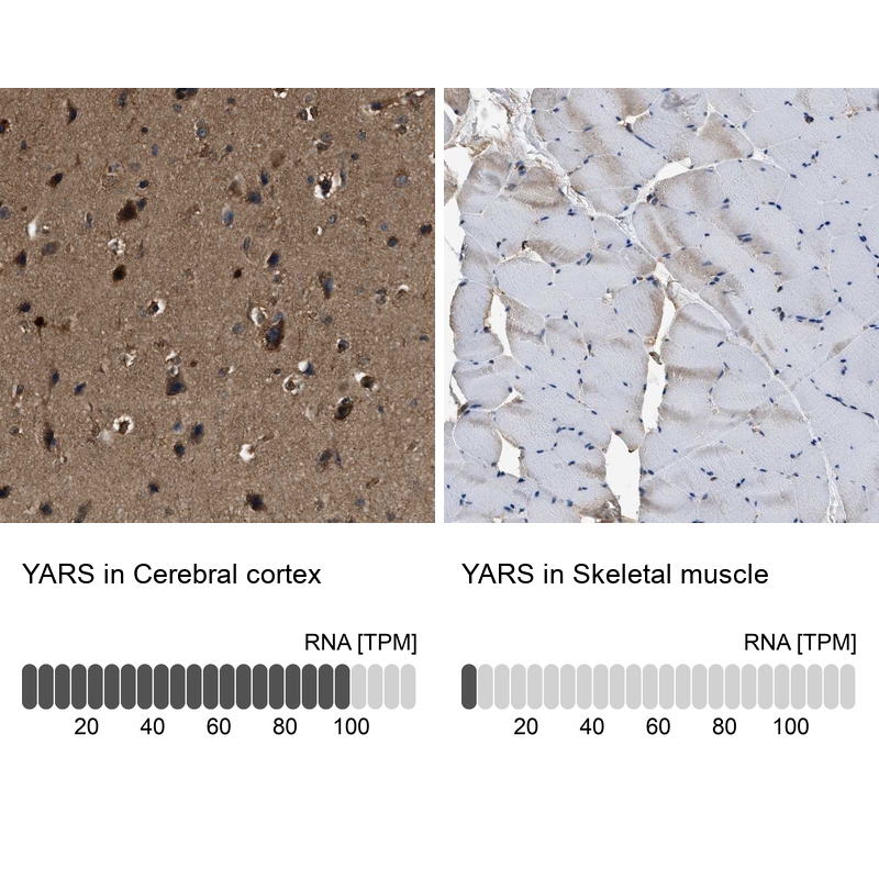 Anti-YARS Antibody