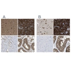 Immunohistochemical staining of human cerebral cortex, pancreas, skeletal muscle and testis using Anti-YARS antibody HPA017936 (A) shows similar protein distribution across tissues to independent antibody HPA018950 (B).
