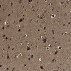 Immunohistochemical staining of human cerebral cortex shows moderate cytoplasmic positivity in neurons.