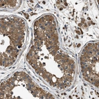 Immunohistochemical staining of human testis shows strong cytoplasmic positivity in cells in seminiferous ducts.