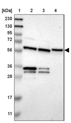 Lane 1: Marker [kDa] 230, 130, 95, 72, 56, 36, 28, 17, 11_br/_Lane 2: Human cell line RT-4_br/_Lane 3: Human cell line U-251MG sp_br/_Lane 4: Human plasma (IgG/HSA depleted)