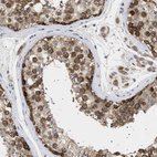 Immunohistochemical staining of human testis shows weak to moderate positivity in nuclear membrane in cells in seminiferous ducts.