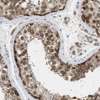 Immunohistochemical staining of human testis shows weak to moderate positivity in nuclear membrane in cells in seminiferous ducts.