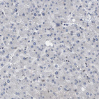 Immunohistochemical staining of human liver shows no positivity in hepatocytes as expected.