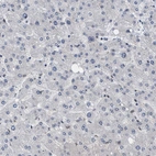 Immunohistochemical staining of human liver shows no positivity in hepatocytes as expected.