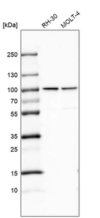 Western blot analysis in human cell line RH-30 and human cell line MOLT-4.