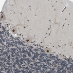 Immunohistochemical staining of human cerebellum shows strong nuclear positivity in Purkinje cells.