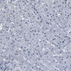 Anti-LRRC8B Antibody