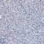Immunohistochemical staining of human liver shows no positivity in hepatocytes as expected.