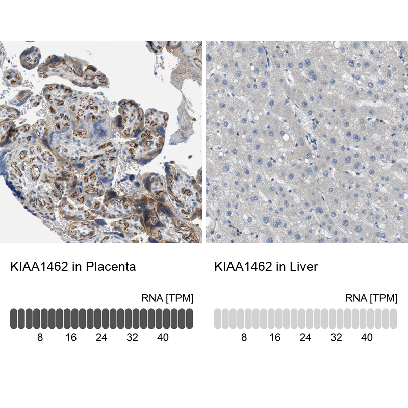 Anti-KIAA1462 Antibody