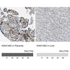 Anti-KIAA1462 Antibody