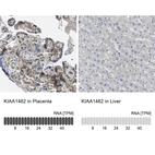 Anti-KIAA1462 Antibody