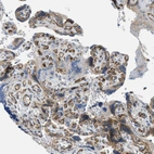 Immunohistochemical staining of human placenta shows strong membranous positivity in endothelial cells.