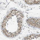 Immunohistochemical staining of human testis shows moderate membranous positivity in cells in seminiferous ducts.