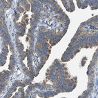 Immunohistochemical staining of human Fallopian tube shows moderate positivity in apical membrane in glandular cells.
