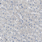 Immunohistochemical staining of human liver shows no positivity in hepatocytes as expected.