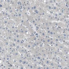 Immunohistochemical staining of human liver shows no positivity in hepatocytes as expected.