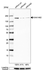 Western blot analysis in U-138MG cells transfected with control siRNA, target specific siRNA probe #1 and #2, using Anti-KIAA1462 antibody. Remaining relative intensity is presented. Loading control: Anti-GAPDH.