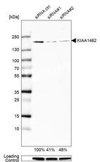 Anti-KIAA1462 Antibody