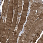 Immunohistochemical staining of human skeletal muscle shows strong cytoplasmic positivity in myocytes.