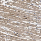 Immunohistochemical staining of human heart muscle shows moderate cytoplasmic positivity in cardiomyocytes.