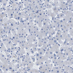 Immunohistochemical staining of human liver shows no positivity in hepatocytes as expected.