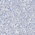 Immunohistochemical staining of human liver shows no positivity in hepatocytes as expected.