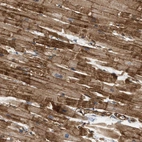 Immunohistochemical staining of human heart muscle shows strong cytoplasmic positivity in cardiomyocytes.