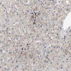 Immunohistochemical staining of human liver shows moderate membranous positivity in hepatocytes.