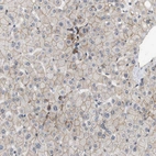 Immunohistochemical staining of human liver shows moderate membranous positivity in hepatocytes.
