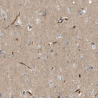 Immunohistochemical staining of human cerebral cortex shows no positivity in neurons.