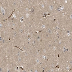 Immunohistochemical staining of human cerebral cortex shows no positivity in neurons.