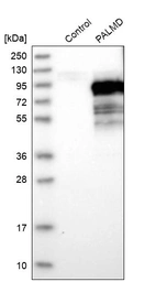 Western blot analysis in control (vector only transfected HEK293T lysate) and PALMD over-expression lysate (Co-expressed with a C-terminal myc-DDK tag (~3.1 kDa) in mammalian HEK293T cells, LY413585).