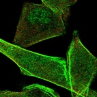 Immunofluorescent staining of human cell line RH-30 shows localization to nucleoplasm & actin filaments.