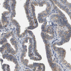 Anti-CORO2B Antibody