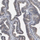 Immunohistochemical staining of human fallopian tube shows weak membranous/cytoplasmic positivity in glandular cells.