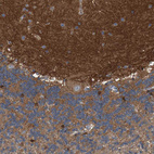 Immunohistochemical staining of human cerebellum shows strong positivity in neuropil.