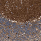 Immunohistochemical staining of human cerebellum shows strong positivity in neuropil.