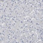 Anti-CORO2B Antibody